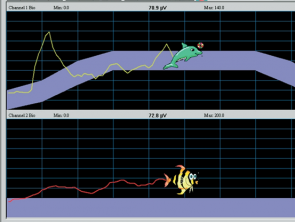 Biofeedback animado de assoalho pélvico